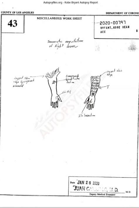 kobe autopsy|Autopsyfiles.org